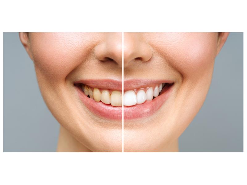 Altın Oran Dental Sağlık Hizmetleri Ticaret Anonim Şirketi